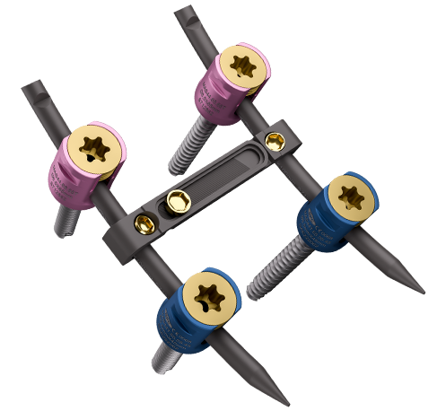 Redonner de la mobilité grâce à des solutions orthopédiques avancées