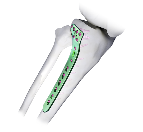 Des solutions orthopédiques complètes pour un soin orthopédique intégral !