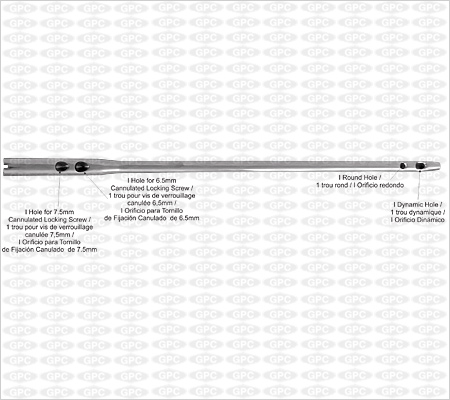 Clou fémoral proximal (CFP long), gauche et droit
